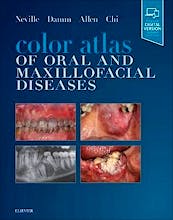 Portada del libro 9780323552257 Color Atlas of Oral and Maxillofacial Diseases (Includes Digital Version)