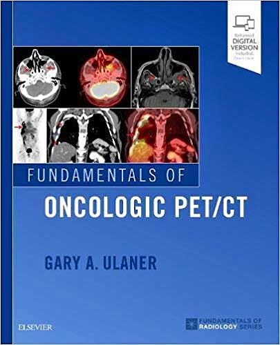 Portada del libro 9780323568692 Fundamentals of Oncologic PET/CT (Print and Online)