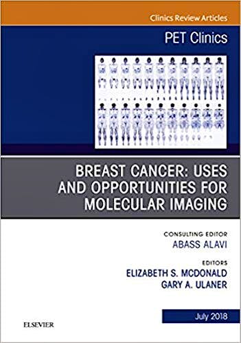 Portada del libro 9780323610629 Breast Cancer. Uses and Opportunities for Molecular Imaging (An Issue of PET Clinics) POD