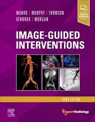 Portada del libro 9780323612043 Image-Guided Interventions (Expert Radiology Series)