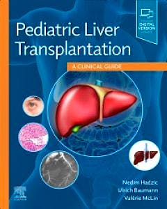 Portada del libro 9780323636711 Pediatric Liver Transplantation. A Clinical Guide