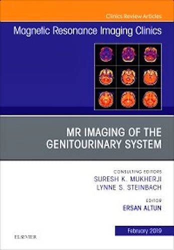 Portada del libro 9780323654739 MRI of the Genitourinary System (An Issue of Magnetic Resonance Imaging Clinics) POD
