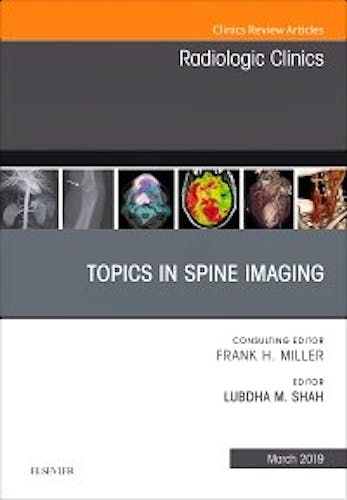 Portada del libro 9780323655323 Topics in Spine Imaging (An Issue of Radiologic Clinics)