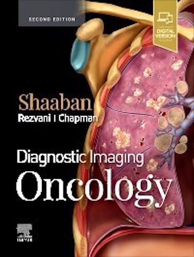 Portada del libro 9780323661126 Diagnostic Imaging. Oncology