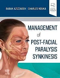 Portada del libro 9780323673310 Management of Post-Facial Paralysis Synkinesis