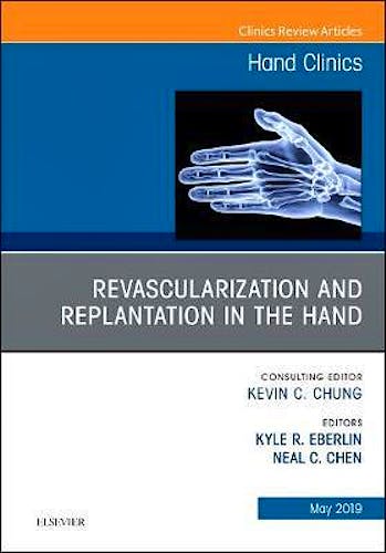 Portada del libro 9780323678438 Revascularization and Replantation in the Hand (An Issue of Hand Clinics) POD