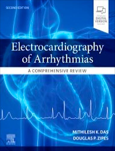 Portada del libro 9780323680509 Electrocardiography of Arrhythmias. A Comprehensive Review