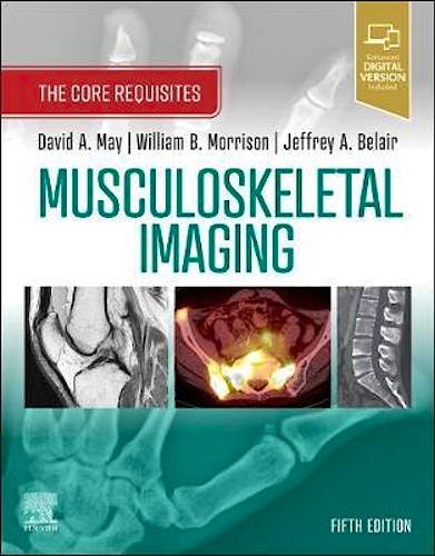 Portada del libro 9780323680592 Musculoskeletal Imaging. The Core Requisites