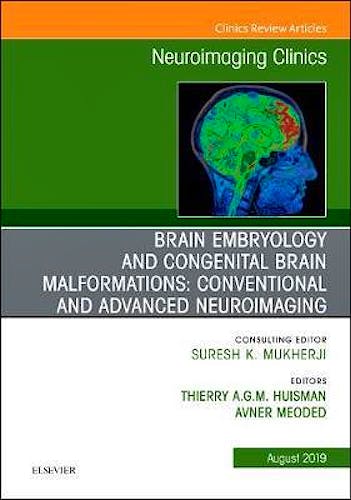 Portada del libro 9780323682466 Brain Embryology and the Cause of Congenital Malformations (An Issue of Neuroimaging Clinics of North America)
