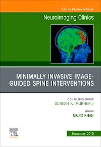 Portada del libro 9780323708845 Spine Intervention (An Issue of Neuroimaging Clinics)