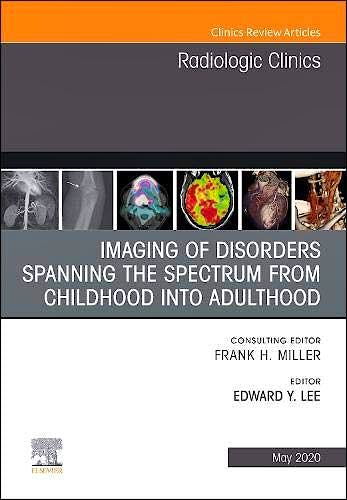 Portada del libro 9780323711166 Imaging of Disorders Spanning the Spectrum from Childhood (An Issue of Radiologic Clinics)