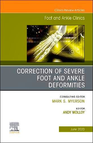 Portada del libro 9780323712958 Correction of Severe Foot and Ankle Deformities (An issue of Foot and Ankle Clinics)