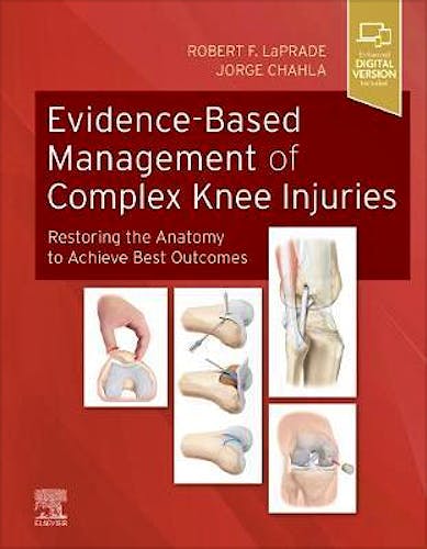 Portada del libro 9780323713108 Evidence-Based Management of Complex Knee Injuries. Restoring the Anatomy to Achieve Best Outcomes