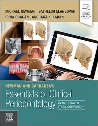 Newman and Carranza's Essentials of Clinical Periodontology. An Integrated Study Companion
