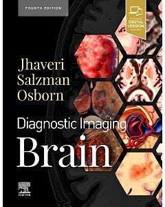 Portada del libro 9780323756204 Diagnostic Imaging. Brain
