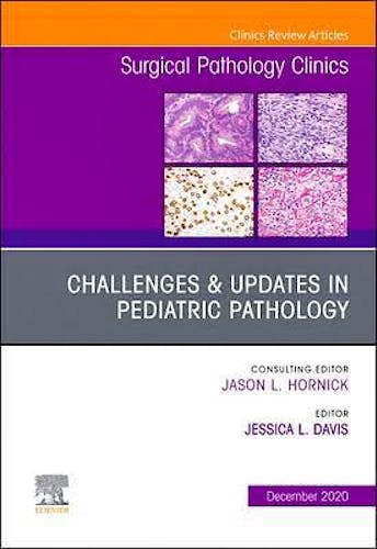 Portada del libro 9780323775786 Challenges and Updates in Pediatric Pathology (An Issue of Surgical Pathology Clinics)