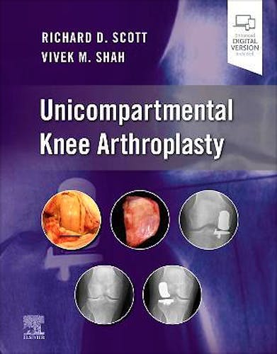 Portada del libro 9780323790109 Unicompartmental Knee Arthroplasty