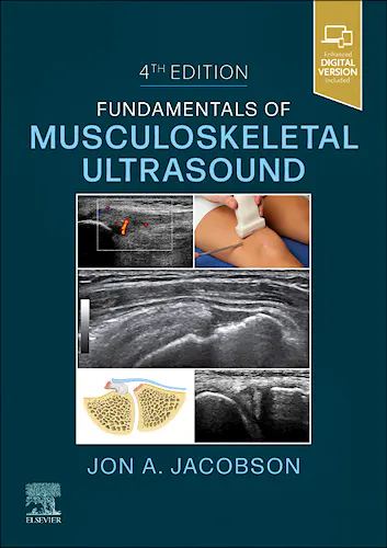 Portada del libro 9780323791502 Fundamentals of Musculoskeletal Ultrasound