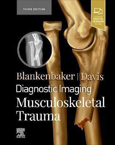 Portada del libro 9780323793933 Diagnostic Imaging. Musculoskeletal Trauma (Includes Digital Version)