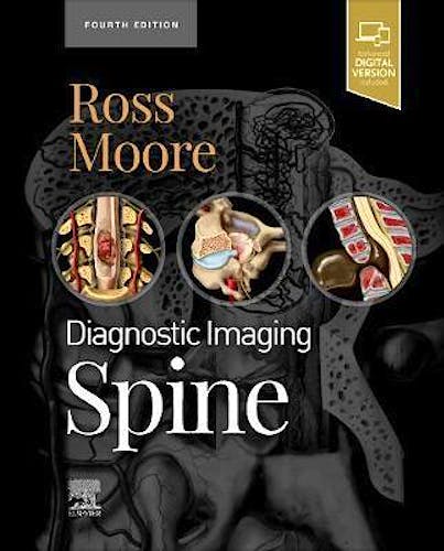 Portada del libro 9780323793995 Diagnostic Imaging. Spine