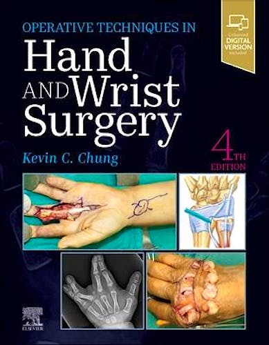Portada del libro 9780323794152 Operative Techniques in Hand and Wrist Surgery