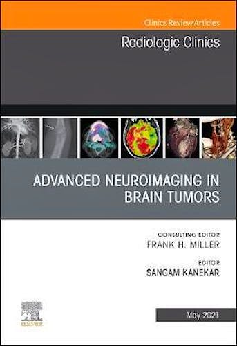 Portada del libro 9780323794213 Advanced Neuroimaging in Brain Tumors. An Issue of Radiologic Clinics