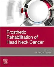 Prosthetic Rehabilitation of Head and Neck Cancer Patients