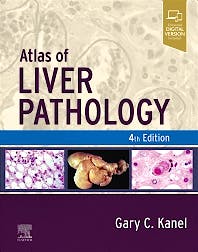 Portada del libro 9780323825337 Atlas of Liver Pathology