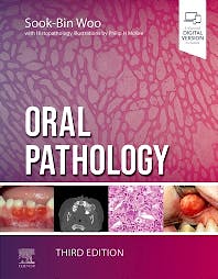 Portada del libro 9780323829182 Oral Pathology