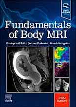 Portada del libro 9780323833813 Fundamentals of Body MRI