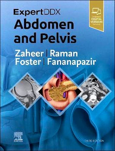 Portada del libro 9780323878661 Expert DDX. Abdomen and Pelvis