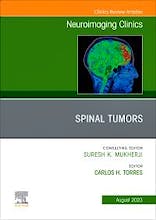 Portada del libro 9780323938679 Spinal Tumors. An Issue of Neuroimaging Clinics