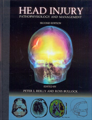 Portada del libro 9780340807248 Head Injury. Pathophysiology and Management