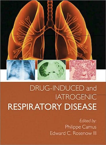 Portada del libro 9780340809730 Drug-Induced and Iatrogenic Respiratory Disease