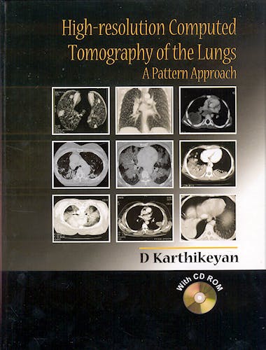 Portada del libro 9780340905807 High-Resolution Computed Tomography. a Pattern Approach