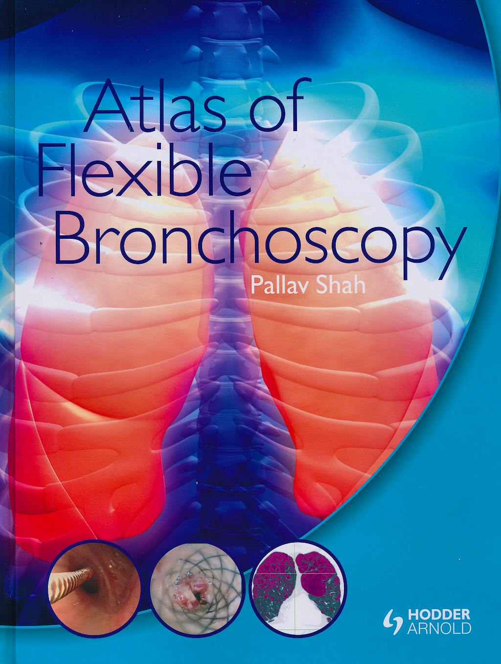 Portada del libro 9780340968321 Atlas of Flexible Bronchoscopy