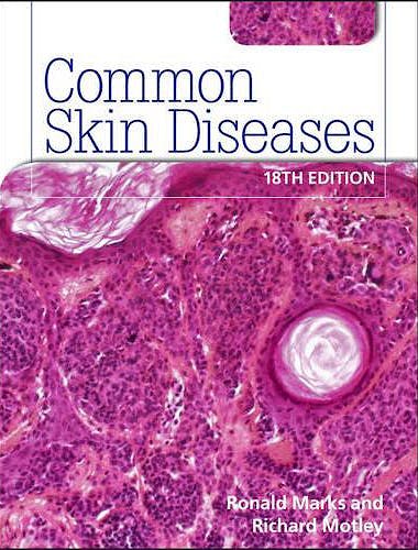 Portada del libro 9780340983508 Common Skin Diseases