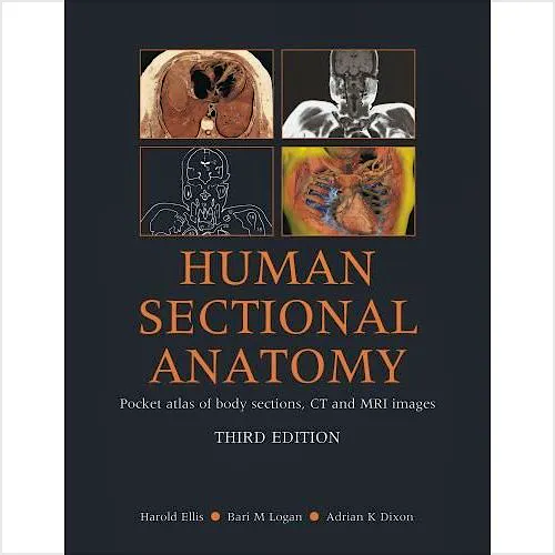 Portada del libro 9780340985168 Human Sectional Anatomy. Pocket Atlas of Body Sections, Ct and Mri Images
