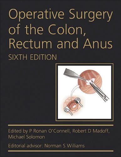 Portada del libro 9780340991275 Operative Surgery of the Colon, Rectum and Anus