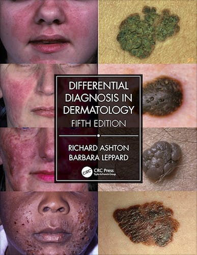 Portada del libro 9780367085971 Differential Diagnosis in Dermatology