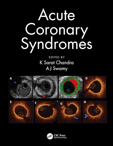 Portada del libro 9780367112226 Acute Coronary Syndromes