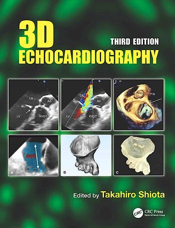 Portada del libro 9780367252885 3D Echocardiography