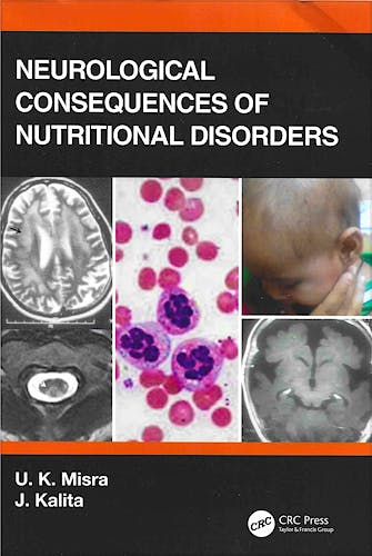 Portada del libro 9780367313449 Neurological Consequences of Nutritional Disorders