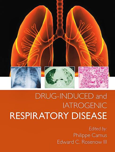 Portada del libro 9780367452308 Drug-induced and Iatrogenic Respiratory Disease