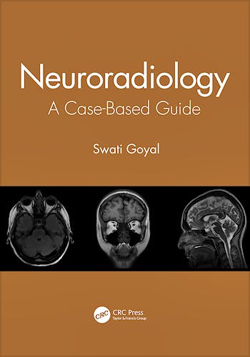 Portada del libro 9780367903190 Neuroradiology. A Case-Based Guide