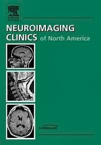 Portada del libro 9780375727009 Cerebral Aneurysms. Neuroimaging Clinics of North America, vol.7. Nr. 4, 1997