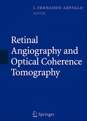 Portada del libro 9780387689869 Retinal Angiography and Optical Coherence Tomography