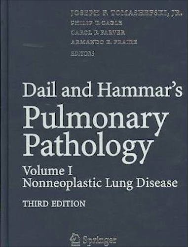 Portada del libro 9780387721392 Dail and Hammar's Pulmonary Pathology Volume I: Non-neoplastic Lung Disease Volume II: Neoplastic Lung Disease