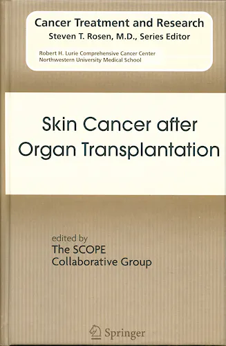Portada del libro 9780387785738 Skin Cancer after Organ Transplantation (Cancer Treatment and Research, Vol. 146)