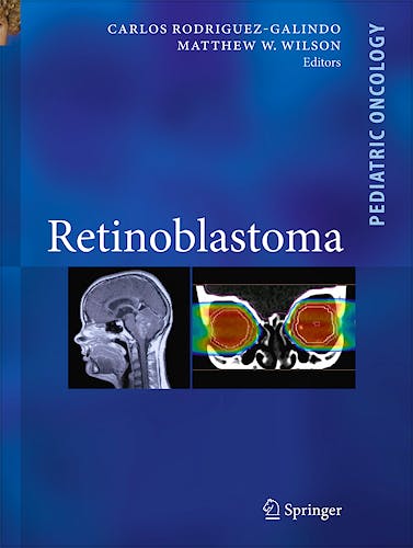 Portada del libro 9780387890715 Retinoblastoma